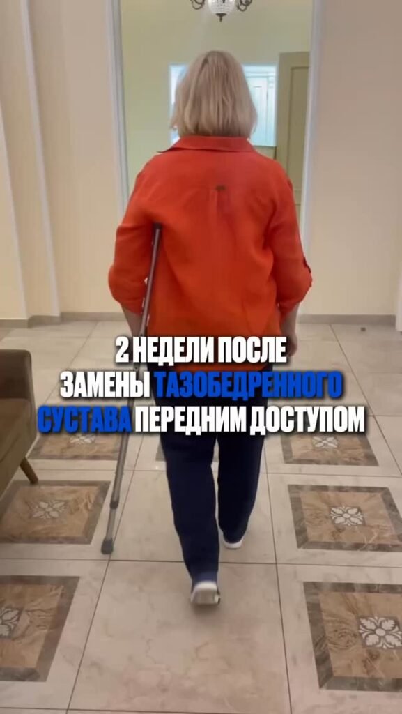 2 недели после эндопротезирования тазобедренного сустава передним доступом.