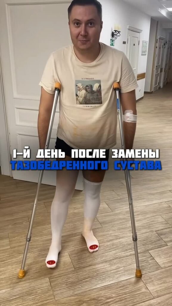 1 день и 8 месяцев после замены тазобедренного сустава.