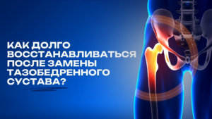 Как долго восстанавливаться после замены тазобедренного сустава? Полный гид по этапам
