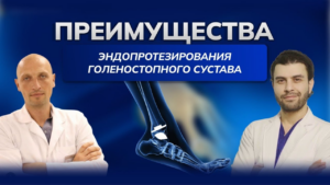 Эндопротезирование голеностопного сустава: современная альтернатива артродезу