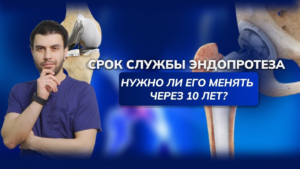 Срок службы эндопротеза: нужно ли готовиться к повторной операции через 10 лет?
