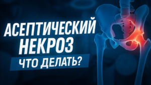 Асептический некроз (АНГБК): почему медлить нельзя и как спасти сустав?