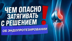 Почему опасно затягивать с эндопротезированием? Правда, которую важно осознать