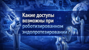 Доступы при эндопротезировании: как путь к суставу определяет скорость вашего восстановления